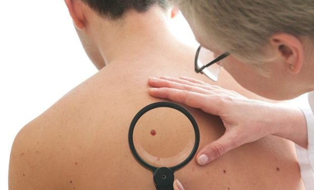 World-first 3D scanning technology could enable earlier detection of skin cancer