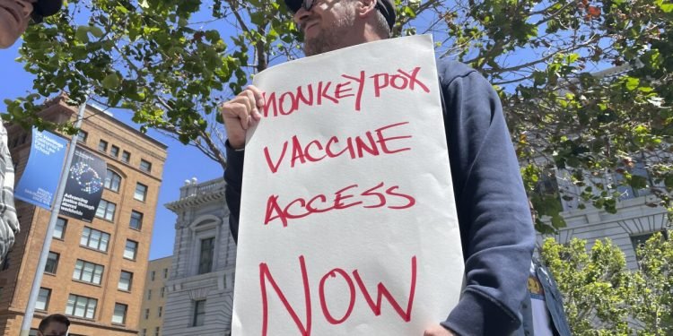 Opinion: Our community fought HIV/AIDs alone. With monkeypox, we’d like more help.