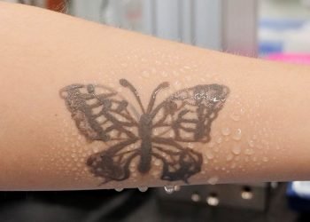 South Korea develops nanotech tattoo as health monitoring device
