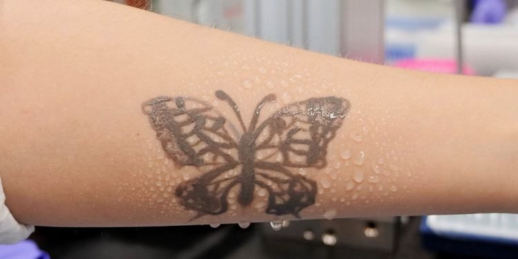 South Korea develops nanotech tattoo as health monitoring device