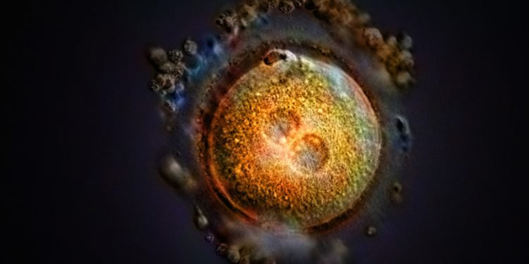 As states try to define when life begins, science, religion and politics clash : Shots