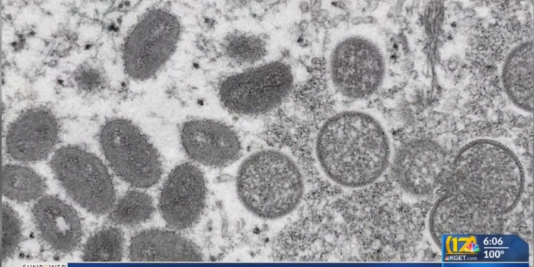 Kern Public health to host a monkeypox vaccination clinic