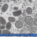 Kern Public health to host a monkeypox vaccination clinic