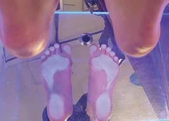 University developing technology to reduce the incidence of diabetic foot complications