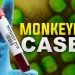 Oregon Health Authority confirms state’s second pediatric monkeypox case