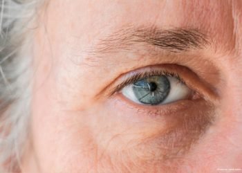 Novel MIGS stent technology boasts robust IOP-lowering effect in open-angle glaucoma